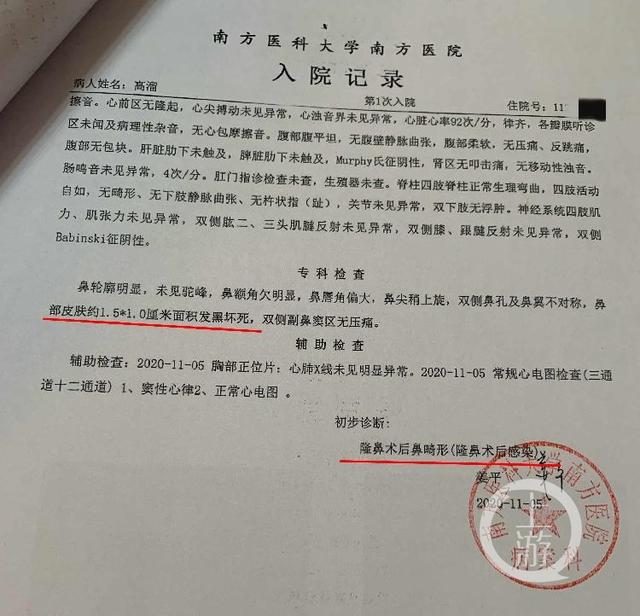 高溜因整容失败原因(女演员高溜自曝整形致鼻尖坏死)(3)