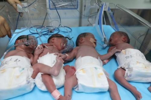 罕见 女子10天内怀3胎的原因(女子十天内怀三胎)-第1张图片-